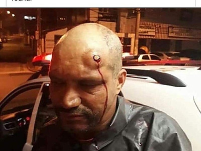 관통은 안됬지만 충격이