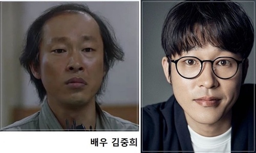 머리카락 중요성
